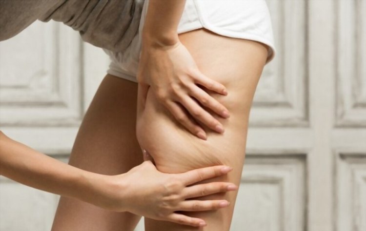 The Pros and Cons of Fat Freezing: A Non-Surgical Weight Loss Approach